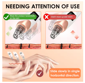 5-in-1 Blackhead remover  Pimple Popper Tool Pore Vacuum